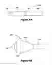 Fig. 07 - Systems and methods for maintaining a narrow body lumen
