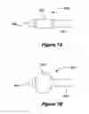 Fig. 08 - Systems and methods for maintaining a narrow body lumen