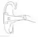 Fig. 01 - MEDICAL INSTRUMENT WITH PROBE AND METHODS OF USING THE SAME