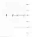 Fig. 10 - Mattress for measuring physiological parameters of heart