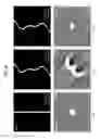 Fig. 10 - RADIATION TOMOGRAPHIC APPARATUS