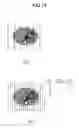Fig. 15 - RADIATION TOMOGRAPHIC APPARATUS
