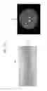 Fig. 13 - Medical imaging apparatus and method for processing medical image
