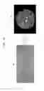 Fig. 15 - Medical imaging apparatus and method for processing medical image
