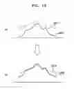 Fig. 16 - Medical imaging apparatus and method for processing medical image
