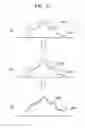 Fig. 17 - Medical imaging apparatus and method for processing medical image