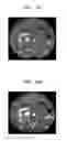 Fig. 18 - Medical imaging apparatus and method for processing medical image