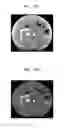 Fig. 19 - Medical imaging apparatus and method for processing medical image