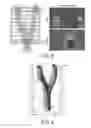 Fig. 05 - Method for aligning spatially different subvolumes of ultrasonic data of a blood vessel