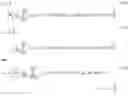 Fig. 08 - Lung tissue identification in anatomically intelligent echocardiography