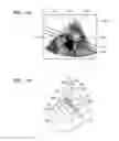 Fig. 07 - Ultrasound diagnostic apparatus, operating method thereof, and computer-readable recording medium