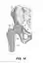 Fig. 02 - SYSTEM AND METHOD FOR IMAGE-GUIDED ARTHROSCOPY