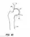 Fig. 04 - SYSTEM AND METHOD FOR IMAGE-GUIDED ARTHROSCOPY