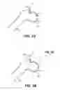 Fig. 05 - SYSTEM AND METHOD FOR IMAGE-GUIDED ARTHROSCOPY