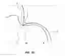 Fig. 06 - SYSTEM AND METHOD FOR IMAGE-GUIDED ARTHROSCOPY