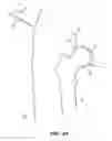 Fig. 07 - SYSTEM AND METHOD FOR IMAGE-GUIDED ARTHROSCOPY
