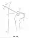 Fig. 08 - SYSTEM AND METHOD FOR IMAGE-GUIDED ARTHROSCOPY