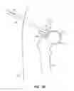 Fig. 10 - SYSTEM AND METHOD FOR IMAGE-GUIDED ARTHROSCOPY