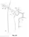 Fig. 12 - SYSTEM AND METHOD FOR IMAGE-GUIDED ARTHROSCOPY