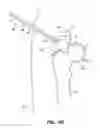 Fig. 13 - SYSTEM AND METHOD FOR IMAGE-GUIDED ARTHROSCOPY