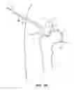Fig. 14 - SYSTEM AND METHOD FOR IMAGE-GUIDED ARTHROSCOPY