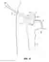 Fig. 15 - SYSTEM AND METHOD FOR IMAGE-GUIDED ARTHROSCOPY