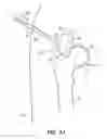 Fig. 16 - SYSTEM AND METHOD FOR IMAGE-GUIDED ARTHROSCOPY
