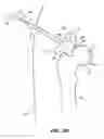 Fig. 17 - SYSTEM AND METHOD FOR IMAGE-GUIDED ARTHROSCOPY