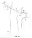 Fig. 18 - SYSTEM AND METHOD FOR IMAGE-GUIDED ARTHROSCOPY