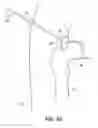 Fig. 21 - SYSTEM AND METHOD FOR IMAGE-GUIDED ARTHROSCOPY