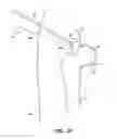 Fig. 22 - SYSTEM AND METHOD FOR IMAGE-GUIDED ARTHROSCOPY