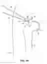 Fig. 24 - SYSTEM AND METHOD FOR IMAGE-GUIDED ARTHROSCOPY