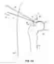 Fig. 25 - SYSTEM AND METHOD FOR IMAGE-GUIDED ARTHROSCOPY