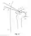 Fig. 26 - SYSTEM AND METHOD FOR IMAGE-GUIDED ARTHROSCOPY