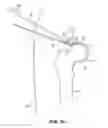 Fig. 27 - SYSTEM AND METHOD FOR IMAGE-GUIDED ARTHROSCOPY