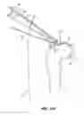 Fig. 29 - SYSTEM AND METHOD FOR IMAGE-GUIDED ARTHROSCOPY