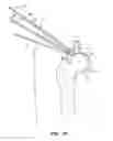 Fig. 30 - SYSTEM AND METHOD FOR IMAGE-GUIDED ARTHROSCOPY