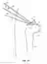 Fig. 31 - SYSTEM AND METHOD FOR IMAGE-GUIDED ARTHROSCOPY