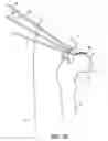 Fig. 32 - SYSTEM AND METHOD FOR IMAGE-GUIDED ARTHROSCOPY