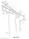 Fig. 33 - SYSTEM AND METHOD FOR IMAGE-GUIDED ARTHROSCOPY