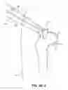 Fig. 34 - SYSTEM AND METHOD FOR IMAGE-GUIDED ARTHROSCOPY