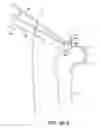 Fig. 35 - SYSTEM AND METHOD FOR IMAGE-GUIDED ARTHROSCOPY