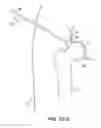 Fig. 38 - SYSTEM AND METHOD FOR IMAGE-GUIDED ARTHROSCOPY