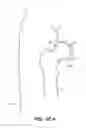 Fig. 41 - SYSTEM AND METHOD FOR IMAGE-GUIDED ARTHROSCOPY