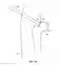 Fig. 42 - SYSTEM AND METHOD FOR IMAGE-GUIDED ARTHROSCOPY