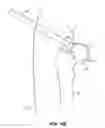 Fig. 43 - SYSTEM AND METHOD FOR IMAGE-GUIDED ARTHROSCOPY