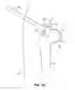 Fig. 44 - SYSTEM AND METHOD FOR IMAGE-GUIDED ARTHROSCOPY