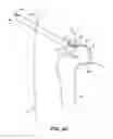 Fig. 45 - SYSTEM AND METHOD FOR IMAGE-GUIDED ARTHROSCOPY