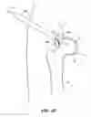 Fig. 47 - SYSTEM AND METHOD FOR IMAGE-GUIDED ARTHROSCOPY