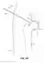 Fig. 50 - SYSTEM AND METHOD FOR IMAGE-GUIDED ARTHROSCOPY